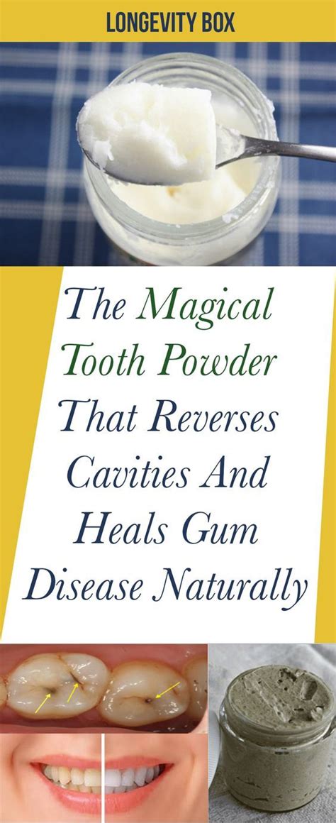 Magic dental